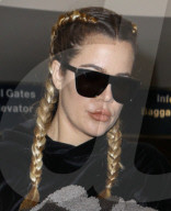 PEOPLE - "Duckmouth" - Hat sich Khloe Kardashian die Lippen aufgespritzt?