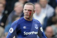 PEOPLE - Wayne Rooney verletzt sich beim Fussball am Auge