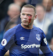 PEOPLE - Wayne Rooney verletzt sich beim Fussball am Auge