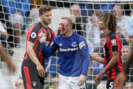 PEOPLE - Wayne Rooney verletzt sich beim Fussball am Auge