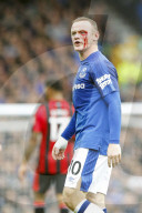 PEOPLE - Wayne Rooney verletzt sich beim Fussball am Auge