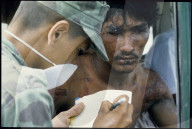 Versorgung der Verletzten nach Vulkanausbruch in Kolumbien 1985