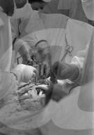 Prof. Ake Senning bei Herztransplantation, Zürich 1969