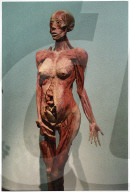 Gunther von Hagens