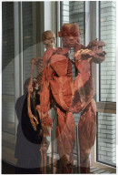 Gunther von Hagens