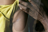 REPORTAGE - Rohingyas in Bangladesch