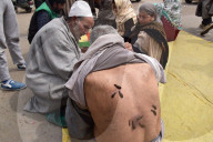 FEATURE - Blutegel Therapie in Indien