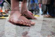 FEATURE - Blutegel Therapie in Indien
