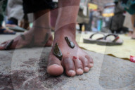 FEATURE - Blutegel Therapie in Indien