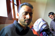 FEATURE - Blutegel Therapie in Indien