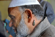 FEATURE - Blutegel Therapie in Indien