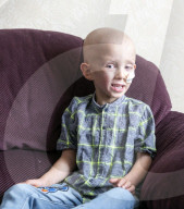 SCHICKSALE - Hodenkrebs mit 5: Der kleine Lucas kämpft sich durch die Chemotherapie