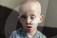 SCHICKSALE - Hodenkrebs mit 5: Der kleine Lucas kämpft sich durch die Chemotherapie