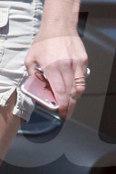 PEOPLE - Britney Spears soll Zahnprobleme haben