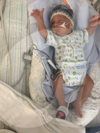 SCHICKSALE - Die Frühchen Jaxon und Axel Martin haben trotz Zwillings-Syndrom überlebt