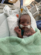 SCHICKSALE - Die Frühchen Jaxon und Axel Martin haben trotz Zwillings-Syndrom überlebt