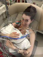 SCHICKSALE - Die Frühchen Jaxon und Axel Martin haben trotz Zwillings-Syndrom überlebt