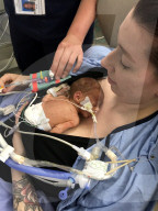 SCHICKSALE - Die Frühchen Jaxon und Axel Martin haben trotz Zwillings-Syndrom überlebt