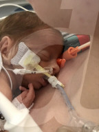 SCHICKSALE - Die Frühchen Jaxon und Axel Martin haben trotz Zwillings-Syndrom überlebt