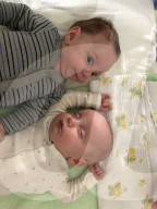 SCHICKSALE - Die Frühchen Jaxon und Axel Martin haben trotz Zwillings-Syndrom überlebt