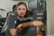FEATURE - Nach Fahrerflucht: Alexus Morris trägt schwere Verletzungen davon