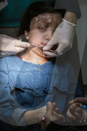 Manhattan doctors help Syrian girl shot in head
