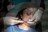 Manhattan doctors help Syrian girl shot in head