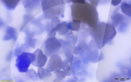 FEATURE - Lapis Lazuli Kristalle im Zahnbelag eines Gebisses aus dem 11. Jahrhundert nachgewiesen