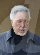 Tom Jones steps out with a nasty looking bruise on his face as he takes a break during his world concert tour.