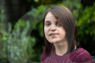 SCHICKSALE - Selbstvertrauen trotz ihres schiefen Gesichts: Die 26jährige Karla Deyes hat nunmehr die Liebe ihres Lebens gefunden