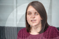 SCHICKSALE - Selbstvertrauen trotz ihres schiefen Gesichts: Die 26jährige Karla Deyes hat nunmehr die Liebe ihres Lebens gefunden