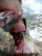 FEATURE -  Bärenattacke überlebt: Andi Bauer konnte einen Bär beim Bergsteigen in Rumänien in die Flucht treiben