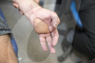 Hand left hanging by ‘chop saw’