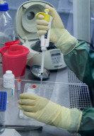 NEWS - Coronavirus: Labor in Omsk arbeitet an Diagnose-Tests