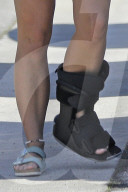 EXKLUSIV - Britney Spears humpelt mit einem Gips ins Tanning-Studio
