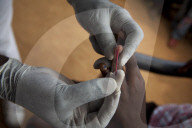 Sleeping Sickness (HAT) in DRC.