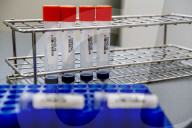 NEWS - Coronavirus: AMitarbeiter des Microvida-Labor in Roosendaal testen bis zu 500 Proben am Tag