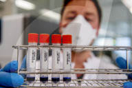 NEWS - Coronavirus: AMitarbeiter des Microvida-Labor in Roosendaal testen bis zu 500 Proben am Tag