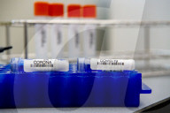 NEWS - Coronavirus: AMitarbeiter des Microvida-Labor in Roosendaal testen bis zu 500 Proben am Tag