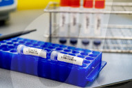 NEWS - Coronavirus: AMitarbeiter des Microvida-Labor in Roosendaal testen bis zu 500 Proben am Tag
