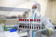 NEWS - Coronavirus:   Covid-19-Behandlung im Klinischen Krankenhaus in Moskau