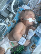 SCHICKSALE - Sepsis in der Schwangerschaft: Betroffene warnt werdende Mütter vor der Gefahr