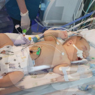 SCHICKSALE - Sepsis in der Schwangerschaft: Betroffene warnt werdende Mütter vor der Gefahr