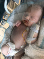 SCHICKSALE - Sepsis in der Schwangerschaft: Betroffene warnt werdende Mütter vor der Gefahr