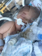 SCHICKSALE - Sepsis in der Schwangerschaft: Betroffene warnt werdende Mütter vor der Gefahr