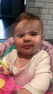 SCHICKSALE -  Retinoblastom: Nach einer Tumoroperation am Auge ist die 1-jährige Dela Rose wieder wohlauf