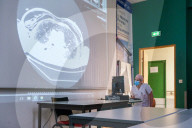 NEWS - Coronavirus: Rehabilitation von Post-Covdi-Patienten in Reims