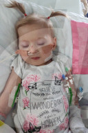 SCHICKSALE - Schulbeginn für Mädchen mit 11 Herzfehlern