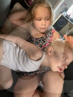 SCHICKSALE - Kinderschicksal: Der kleine Lennon Townsend leidet unter einer schwerwiegenden Hauterkrankung