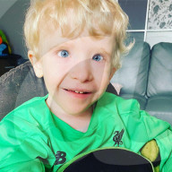 SCHICKSALE - Kinderschicksal: Der kleine Lennon Townsend leidet unter einer schwerwiegenden Hauterkrankung